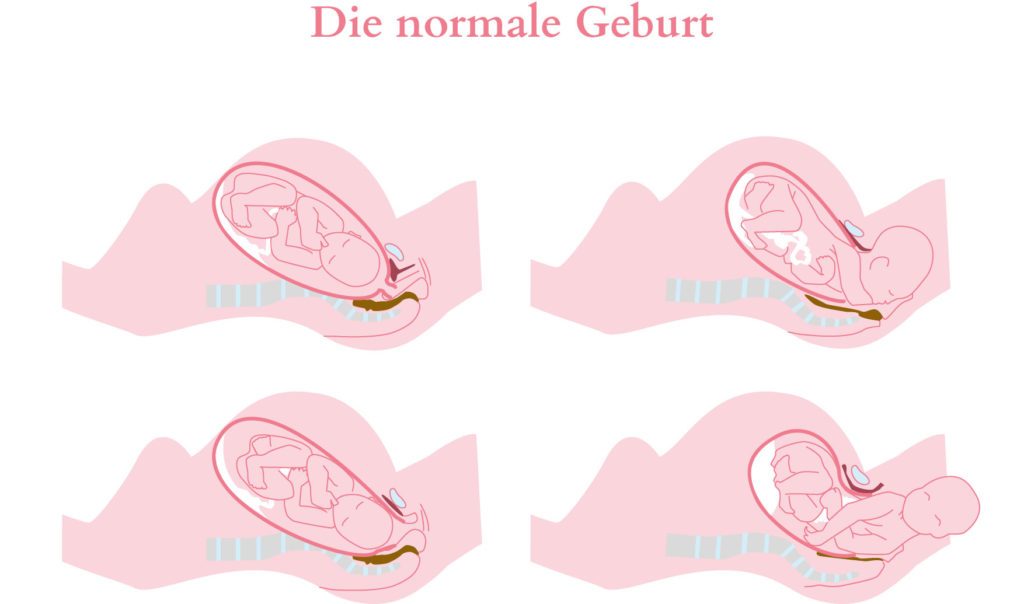 Normale Geburt normale geburt graphik